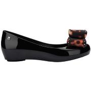 Ballerina's Melissa Ultragirl Classic Bow - Black/Tortoise Sheel