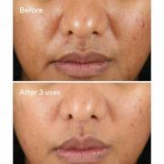 Murad Rapid Relief Masque au Soufre 75 ml