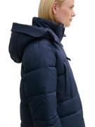 Manteau d’hiver